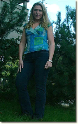 Angie After Gastric Bypass Surgery