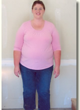 Autumn Before Weight Loss Surgery