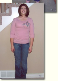 Autumn 5 &frac12; Months After Weight Loss Surgery