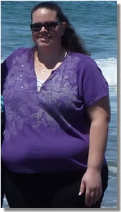 Christine - Before Gastric Bypass Surgery