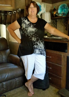 Janet Before Gastric Bypass