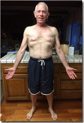 Rich 3 Months after Gastric Bypass