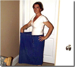 Sheree After Gastric Bypass Surgery