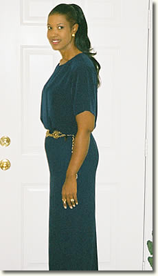 Tina After Gastric Bypass Surgery