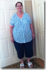 Weight Loss Surgery Patient Before and After